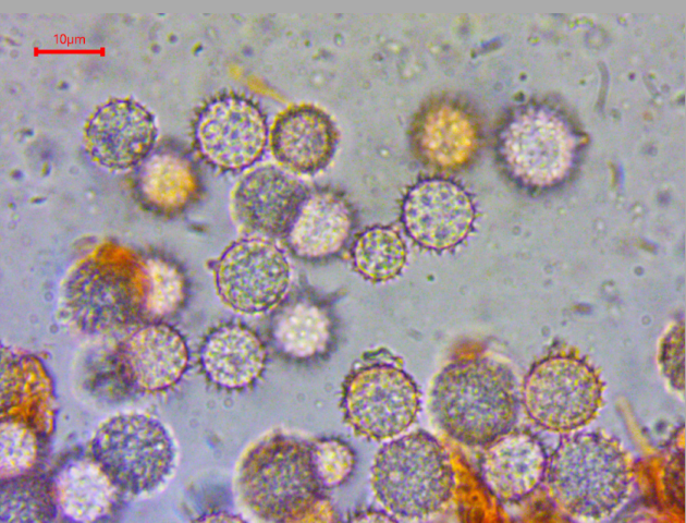 10 Hydnangium carneum Sporen Kongorot Ornament stachelig Apikulus Appendix Basidie Hydnangiaceae Agaricales Mykorrhiza Eucalyptus Mikroskopierkurs Pilzschule Schwaebischer