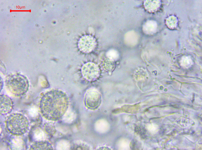 8 Hydnangium carneum Fleischfarbene Heidetrueffel Sporen rund Apikulus stachelig Basidien zweisporig Krieglsteiner Pilzschule Mikroskopierkurs Agaricales Basidiomycetes PSV