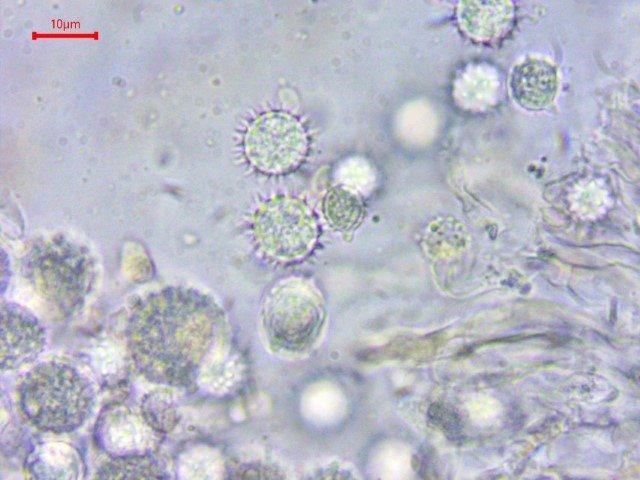 9 Hydnangium carneum Sporen Apikulus stachelig Basidiomycetes Agaricales Hydnangiaceae Fleischfarbene Heidetrueffel Eucalyptus Mykorrhiza halbepigaeisch Hypogaen Trueffel