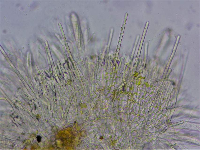 Arachnopeziza obtusipila 5 Randhaare stumpf septiert Exzipulum textura prismatica Portugal Algarve Ascomyceten inoperculate Becherlinge Artenvielfalt