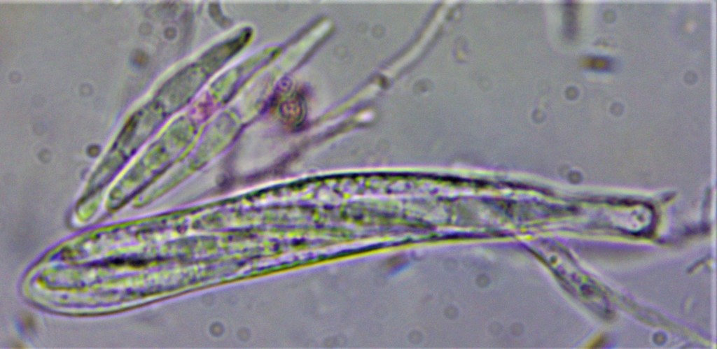 Arachnopeziza obtusipila 8 Ascus 8sporig septiert Sporen kurz Portugal Algarve Serra Monchique Caldas Steineiche Quercus suber Feldmykologe Pilzexpertin