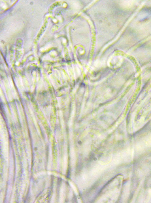 Colpoma crispum 11 Paraphysen guttulat Tropfen lebend Merkmal Vital Taxonomie Baral verzweigt knorrig gebogen haploid Mikroskopierkurs Krieglsteiner Pilzschule