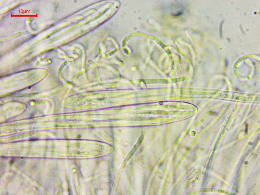 Colpoma crispum 13 Paraphysen knorrig gekruemmt Epithezium Asci 8 sporig parallel Mirkoskopierkurs Pilzschule Schwaebischer Wald Krieglsteiner Katharina Pilzexpertin