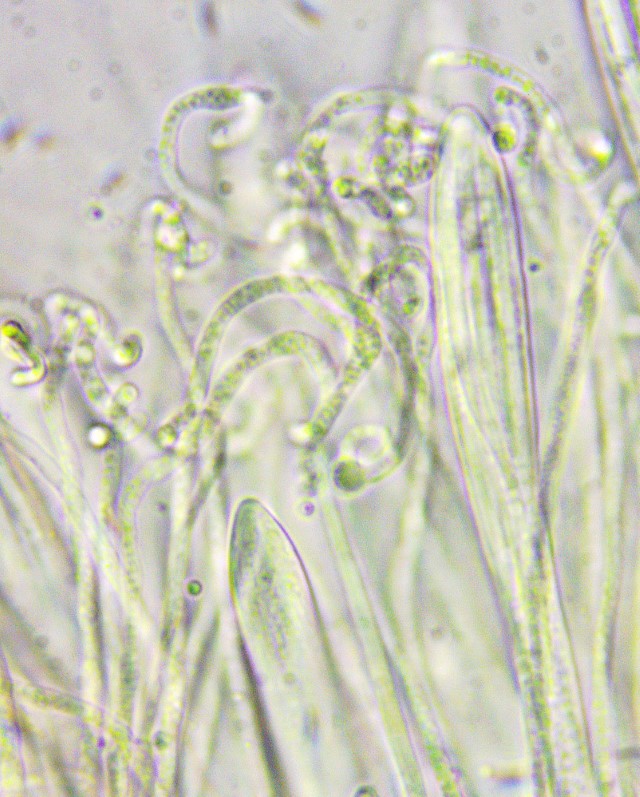 Colpoma crispum 15 Paraphysen guttulat Vakuolen Guttulen Epithezium Krieglsteiner Mikroskopierkurs Slowakei Hohe Tatra nahuby sk Fichtenforst Skipiste Sehnsuchtsort