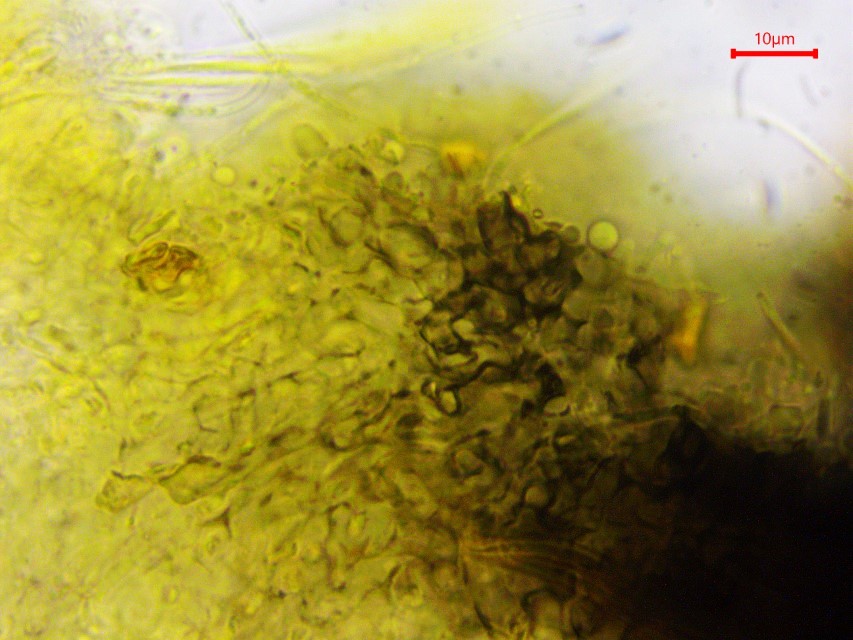 Colpoma crispum 16 Excipulum dunkel Krieglsteiner Mikroskopierkurs Lirellen Becherling Zweige Spaltlippe Slowakei Nationalpark Hohe Tatra Pilzexpertin Feldmykologe