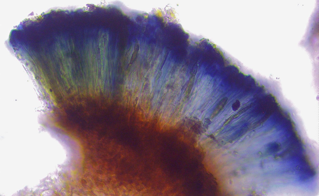 Dactylospora stygia 5 Fruchtschicht Hymenium euamyloid IKI Baral Lugol Flechten Patellariales Mikroskopierkurs Pilzschule Krieglsteiner Mittel