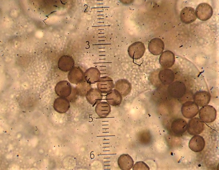 Fuligo muscorum 17 Moos Lohbluete Schwaebisch Fraenkischer Wald Gschwend Rotenhar Sporen Krieglsteiner Pilzschule Myxo Kurs