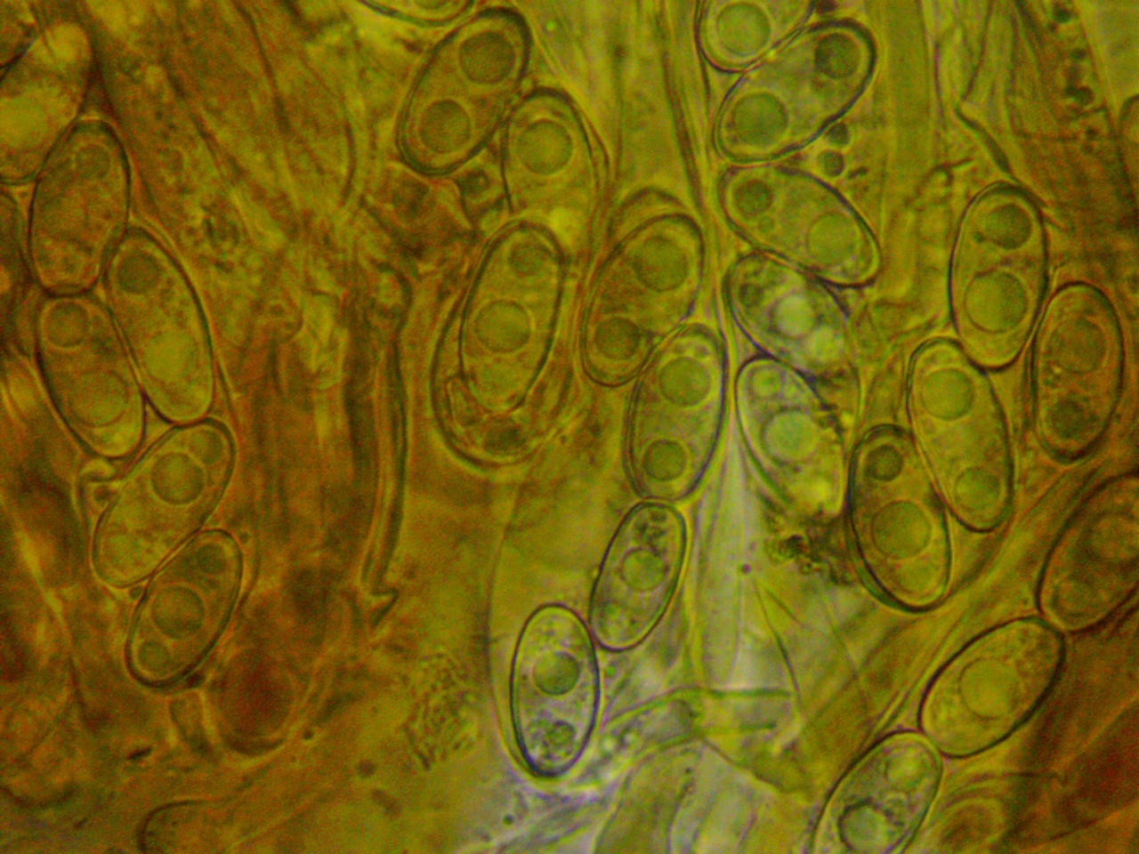 Gyromitra melaleuca Discina Sporen Oeltropfen unreif Schlaeuche Asci Bad Mergentheim