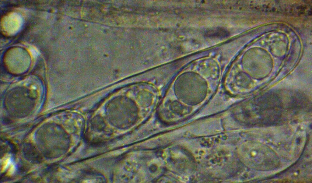 Gyromitra parma Discina perlata ancilis Schlauch Ascus Sporen Tropfen Guttulen Ornament Mikroskopierkurs Morchel Lorchel