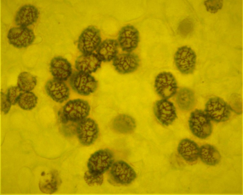 Lactarius lilacinus Lila Miclhling Sporen netzig zebriert spinosulus Schueppchen Melzers Reagens Ornament amyloid Krieglsteiner Pilzschule