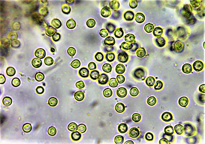 Lycoperdon norvegicum Norwegischer Stubling Schwbischer Wald Baden Wrttemberg Rotenhar Pilzschule Bauchpilzkurs Krieglsteiner Nadelwald Sporen fast glatt