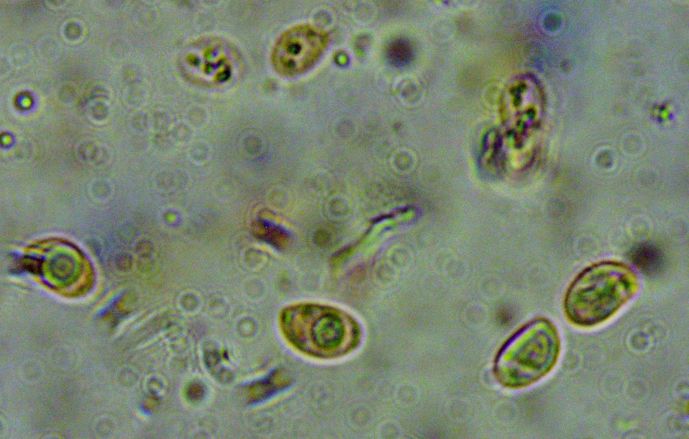 Lyophyllum brunneo ochrascens 10 Ockerblaettriger Rasling Sporen Kongorot ellipsoidisch supraapikale Depression Krieglsteiner Pilzschule Schwaebischer