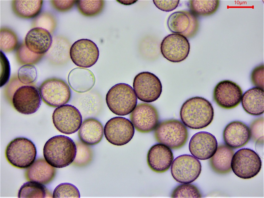 Microbotryum pustulatum 4 Sporen Mikroskopierkurs Pilzschule Schwaebischer Wald Kireglsteiner Schlangenknoeterich Polygonum bistorta officinalis Rote Liste