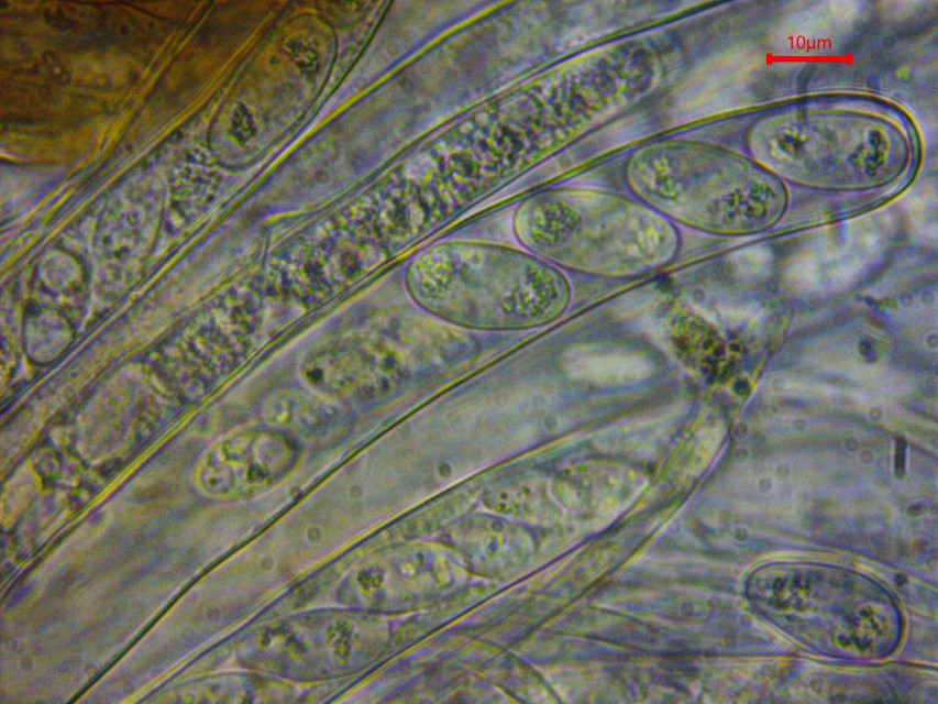 Monilinia baccarum 13 Asci 8 sporig 4 grosse klein guttulat Tropfen Paraphysen Hymenium Baden Wuerttemberg Waldmannshofen Kochertal Untergroningen Ostalbkreis Pilz Custom