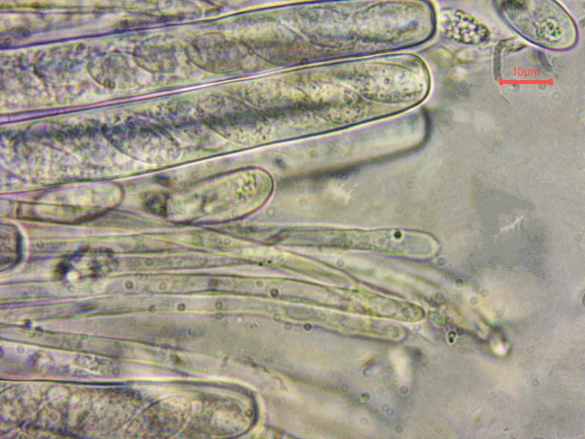 Monilinia baccarum 16 Paraphysen Apices Spitzen keulig fadig filiform clavat Schlaeuche Asci Sclerotiniaceae Sklerotienbecherlinge Fruchtbecherchen Heidelbeer Pilz Custom