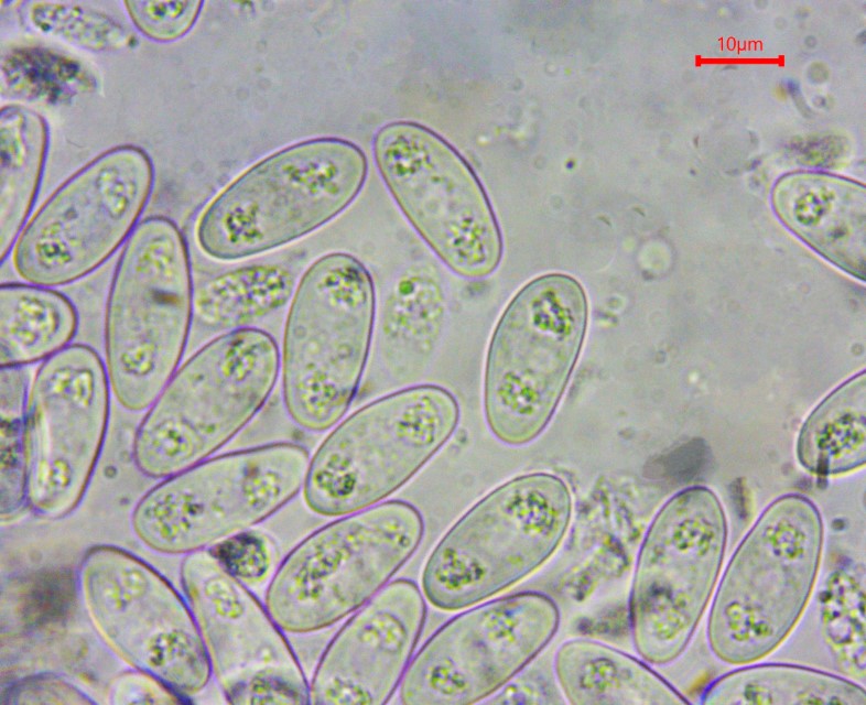 Monilinia baccarum 18 Sporen grosse Guttulen Tropfen Sporeninhalt abgerundet ellipsoidisch Waldmannshofen Kochertal Baden Wurttemberg Wuerttemberg Stuttgart Custom