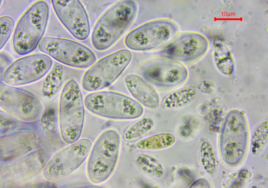 Monilinia baccarum 19 Sporen grosse kleine Sclerotinia trifoliorum Klee Sklerotienbecherling Heidelbeer Fruchtbecherchen deutscher Name lateinischer Pilz Kurs  Custom