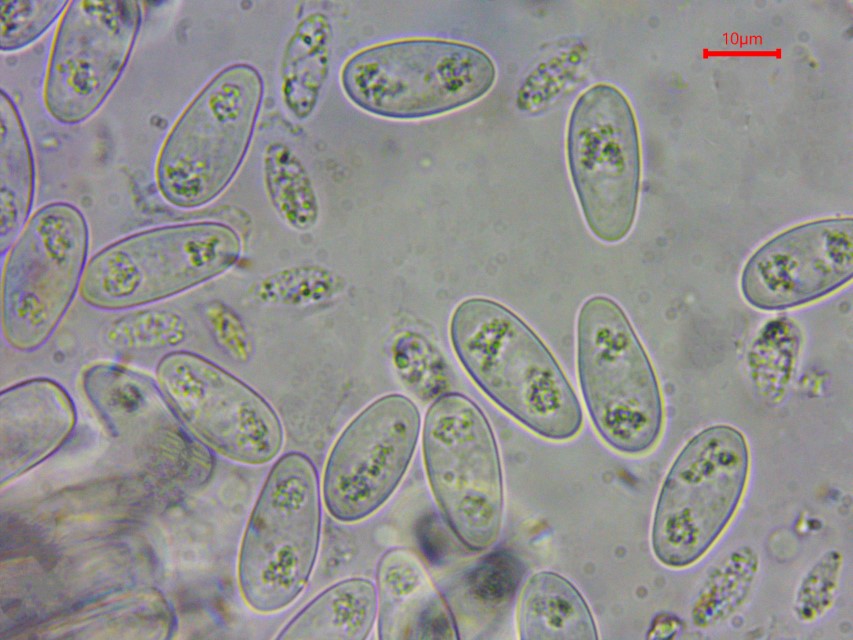 Monilinia baccarum 20 Sporen grosse kleine Mykologe Krieglsteiner German wikipedia Baden Wuerttemberg Deutschland Harz Norwegen Bayerischer Wald Skandinavien Heidel Custom