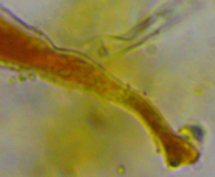 Monilinia baccarum 26 Ascus Haken pleurorhynch Schnallen Basidiomycota Standerpilze Basidie Staender Pilzgruppen Pilzkenntnis Pilzpapst Feldmykologe Pilzexpertin