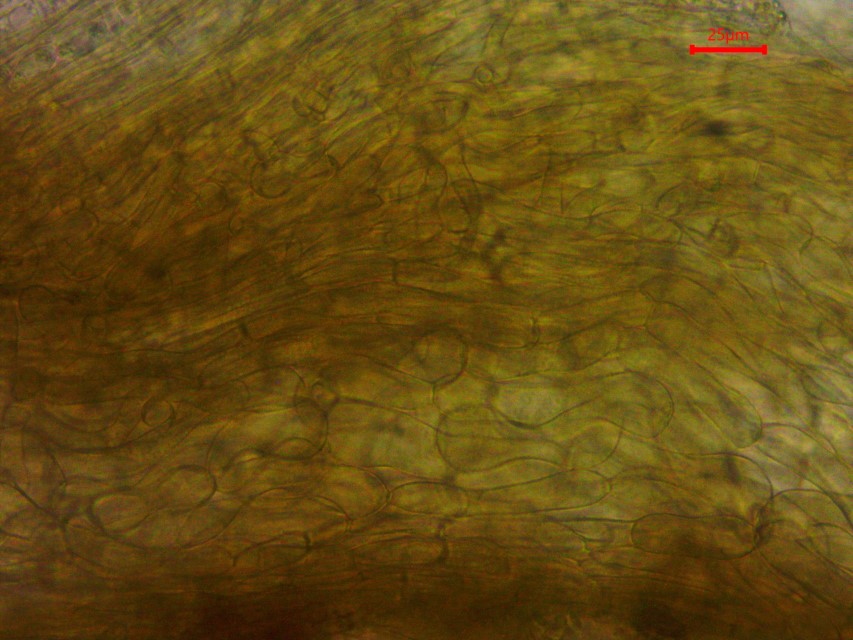 Monilinia baccarum 30 Exzipulum Feldmykologe Ericaceae Heidekrautgewaechse Obst Beeren Fruechte Fruchte fructicol excipulum textura prismatica Zellen Hyphen Gewebe Custom