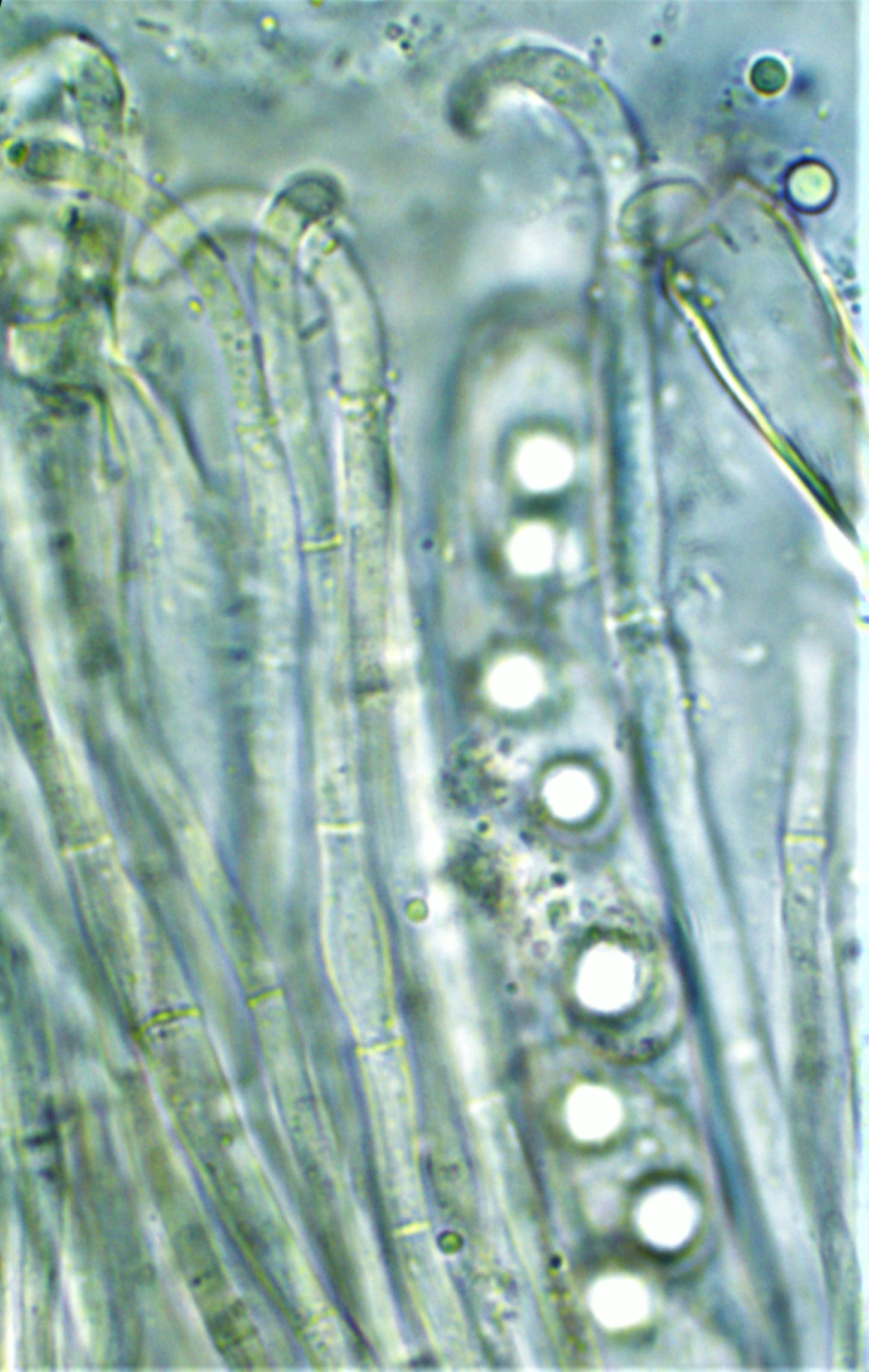 Otidea platyspora Schwaerzender Oehrling Paraphysen Mikroskopie Sporen Oeltropfen Eiche Quercus Parkrasen Schwaebisch Gmuend Ostalbkreis