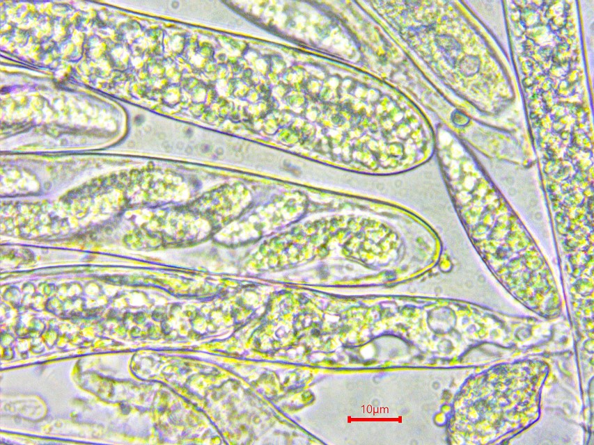 Pezicula acericola 5 Helotiales Ascomycetes Heinz Sielmann Stiftung Ahorn Rindenbecherchen Kartierung Feldmykologe Krieglsteiner Asci Wasser Haken multiguttulat Sporen Ascosporen Pilz