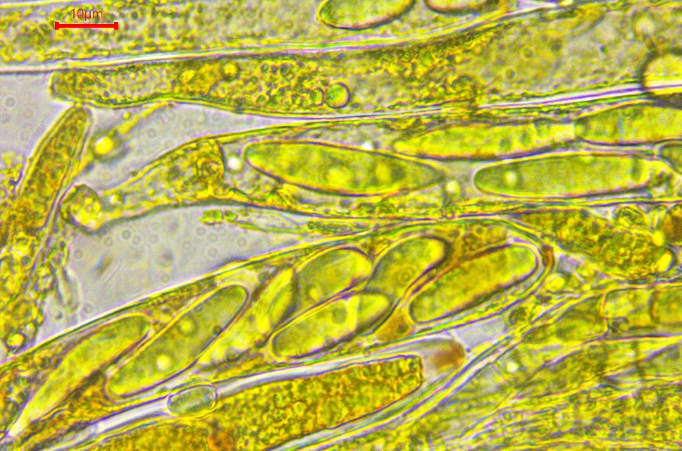 Pezicula acericola 7 Sporen tot Oeltropfen zusammen geflossen Baral Krieglsteiner Feldmykologe Heinz Sielmann Stiftung Kartierung wissenschaftlicher Auftrag Lugol Baral hemiamyloid