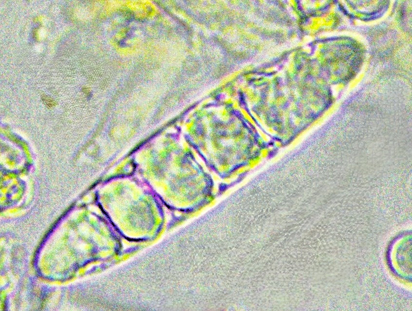 Pezicula acericola 8 Spore tot 5 Septen 7 Zellen Oeltropfen zusammen geflossen multiguttulat Acer pseudoplatanus Weissenstein Heinz Sielmann Stiftung Krieglsteiner Pilzkunde Pilzkurs