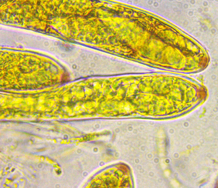 Pezicula acericola 9 Asci Apikalapparat hemiamyloid Vitaltaxonomie Baral rot Lugol Melzer tot lebend Krieglsteiner Bergahorn Ahorn Rindenbecherchen Feldmykologe Krieglsteiner Ostalb