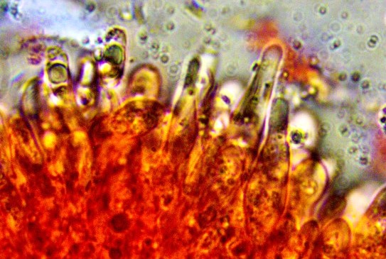 Physalacria cryptomeriae 10a Hymenialzystiden oelreich zugespitzt Kongorot Krieglsteiner Eimann Pilzschule Deutschland Baden Wuerttemberg Neomycet Sicheltanne