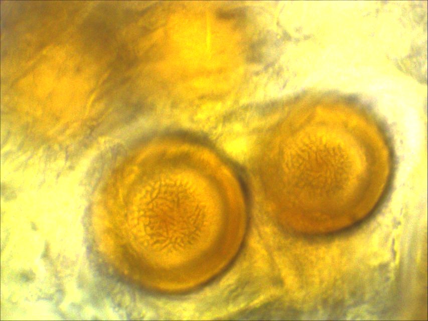 Physoderma potteri 13 Dauersporen Ornament Linien Nationalpark Eifel Torrmoos Niedermoor sauer naehrstoffarm Gallwespe Pilzkurse