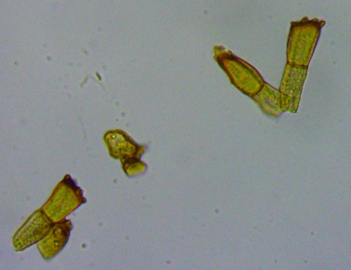 Puccinia coronata Kronenrost Teliosporen Teleutosporen Schwaebisch Gmuend Baden Wuerttemberg Krieglsteiner Pilzschule Schwaebischer Wald Medium