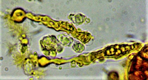 Rhodocybe ardosiaca 8 Violettspitziger Tellerling Chryso Pleuro Pseudozystiden Mikroskopie Feldmykologie amorpher Inhalt tot Krieglsteiner Pilzschule Schwaebischer Wald Schweiz