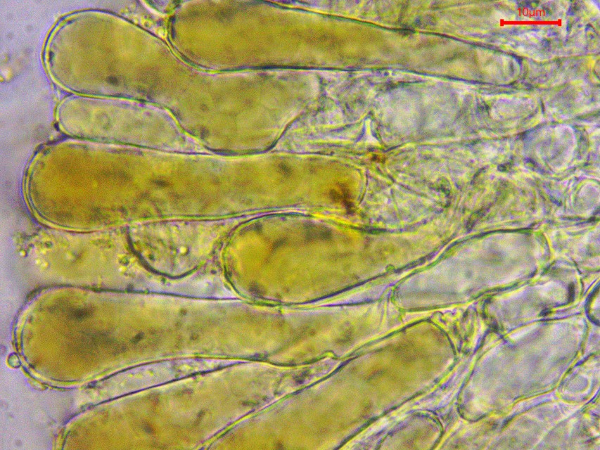 Wynnella silvicola 12 Exzipulum Endzellen Palisade braun keulig intrazellulaer Pigment Krieglsteiner Mikroskopierkurs Feldmykologe PSV Raritaet sehr selten Pilzkurs