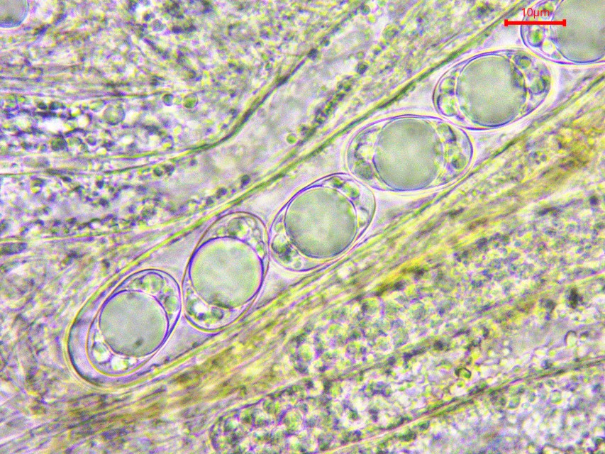 Wynnella silvicola 7 Krieglsteiner Pilzkurse Seminare Ascus 8 sporig Oeltropfen Guttulen eifoermig Paraphysen Pigment Krieglsteiner Mikroskopie Slowakei Muranska